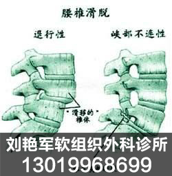 足跟痛治療方法 足跟痛治療方法